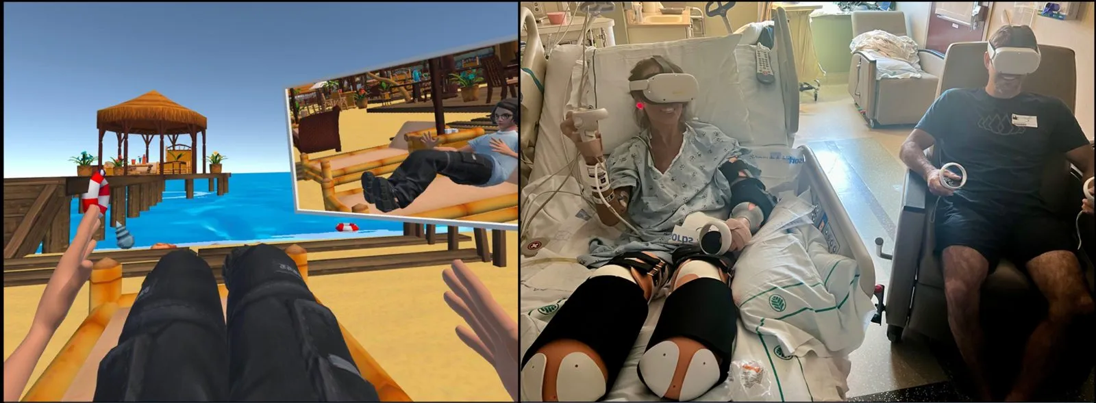The HEAL-XR virtual environment beside patients using it in VR after limb loss.